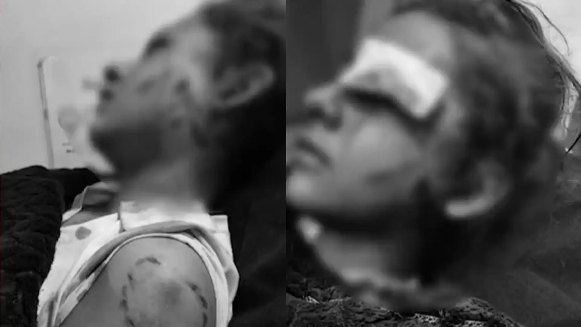 Niña fue agredida y mordida por un desconocido