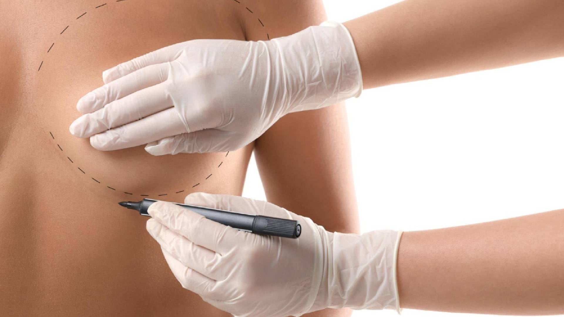 ¿Cómo verificar a un cirujano plástico en Colombia?: Guía de cirugía plástica segura en Colombia