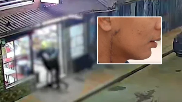 Hombre sobrevivió de milagro luego que un extraño lo apuñalara en el cuello en Soacha