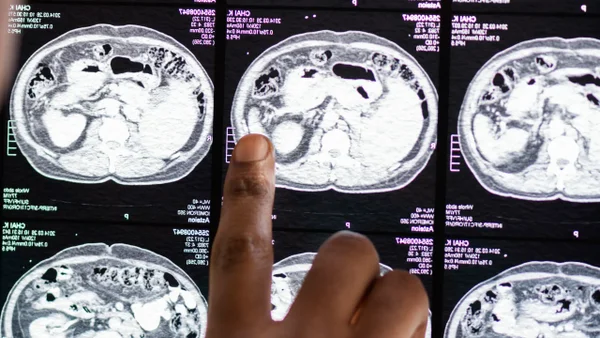 Futbolista sufrió un accidente cerebrovascular en la previa de un partido: este es su estado de salud