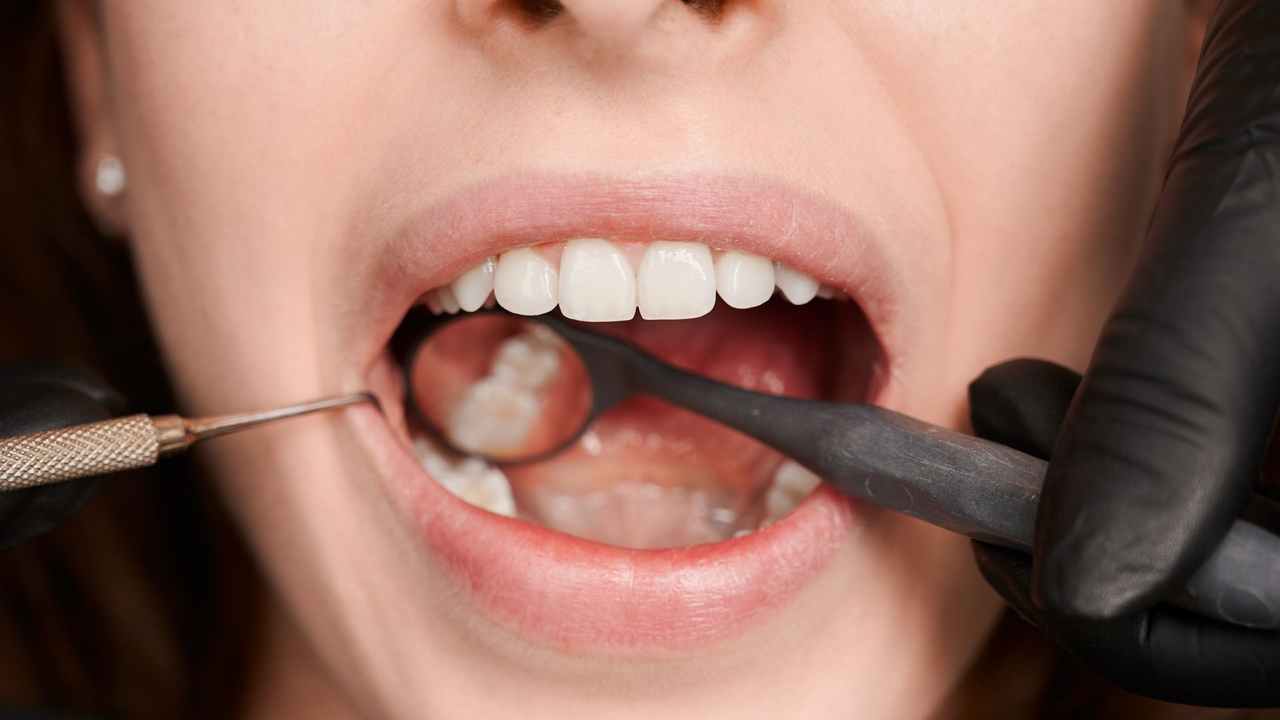 Experts revealed the two foods most likely to cause cavities