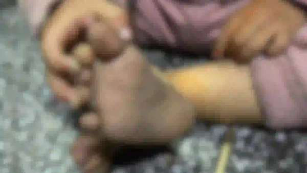 Medicina Legal reveló las torturas que sufrió un niño antes de ser asesinado por su madre en Medellín Medicina Legal reveló las torturas que sufrió un niño antes de ser asesinado por su madre en Medellín