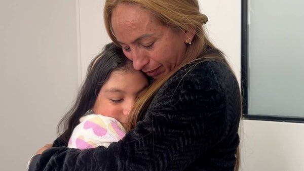 Médicos reconstruyeron el cabello de una niña que perdió el 70% de su cuero cabelludo en Bogotá