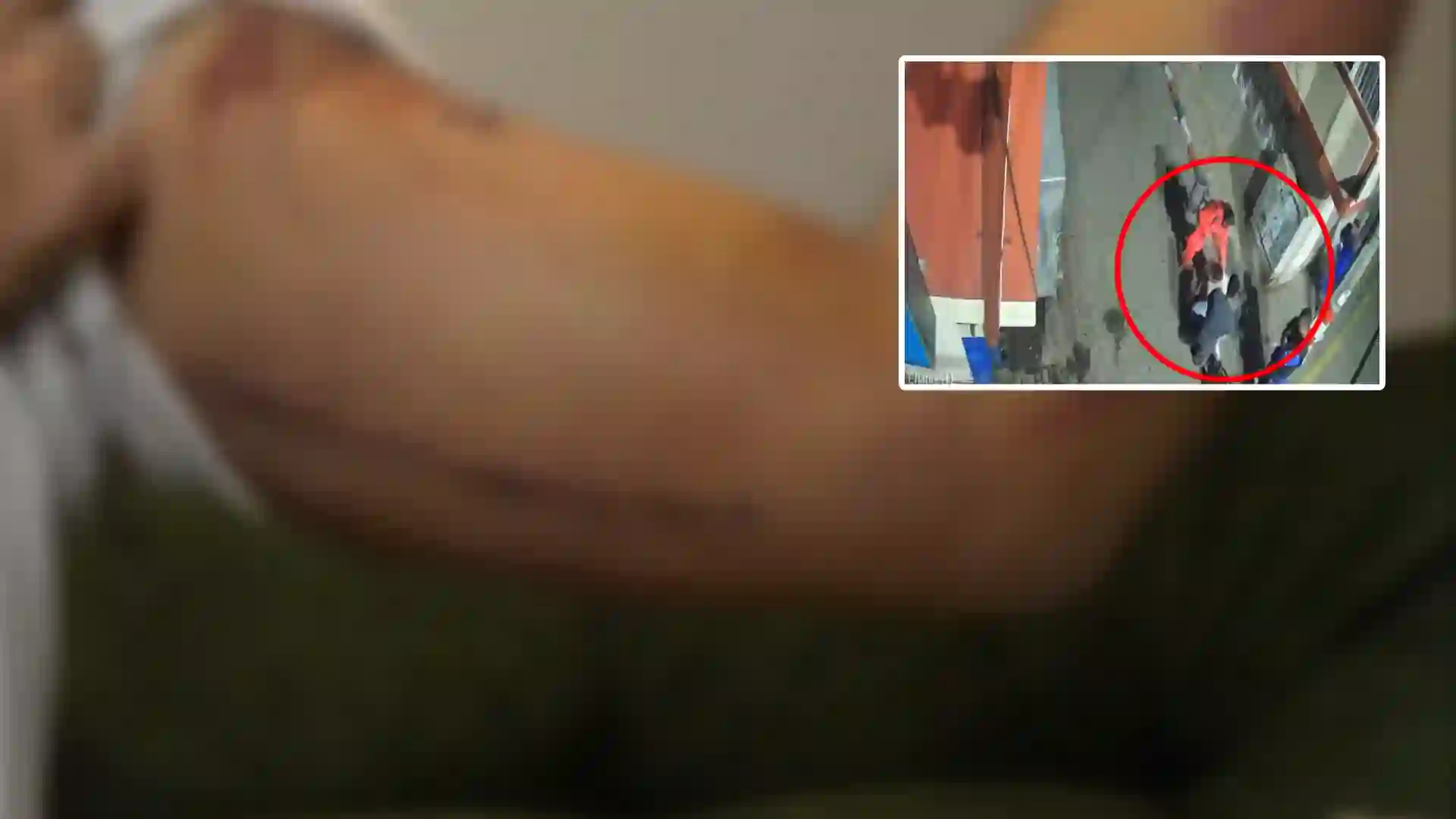 Casi lo matan a puñaladas en un bar de Bogotá y su denuncia quedó en el aire por no tener la cédula del agresor