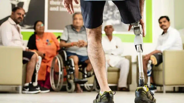 ¿Qué disciplinas deportivas pueden practicar los pacientes amputados con prótesis?