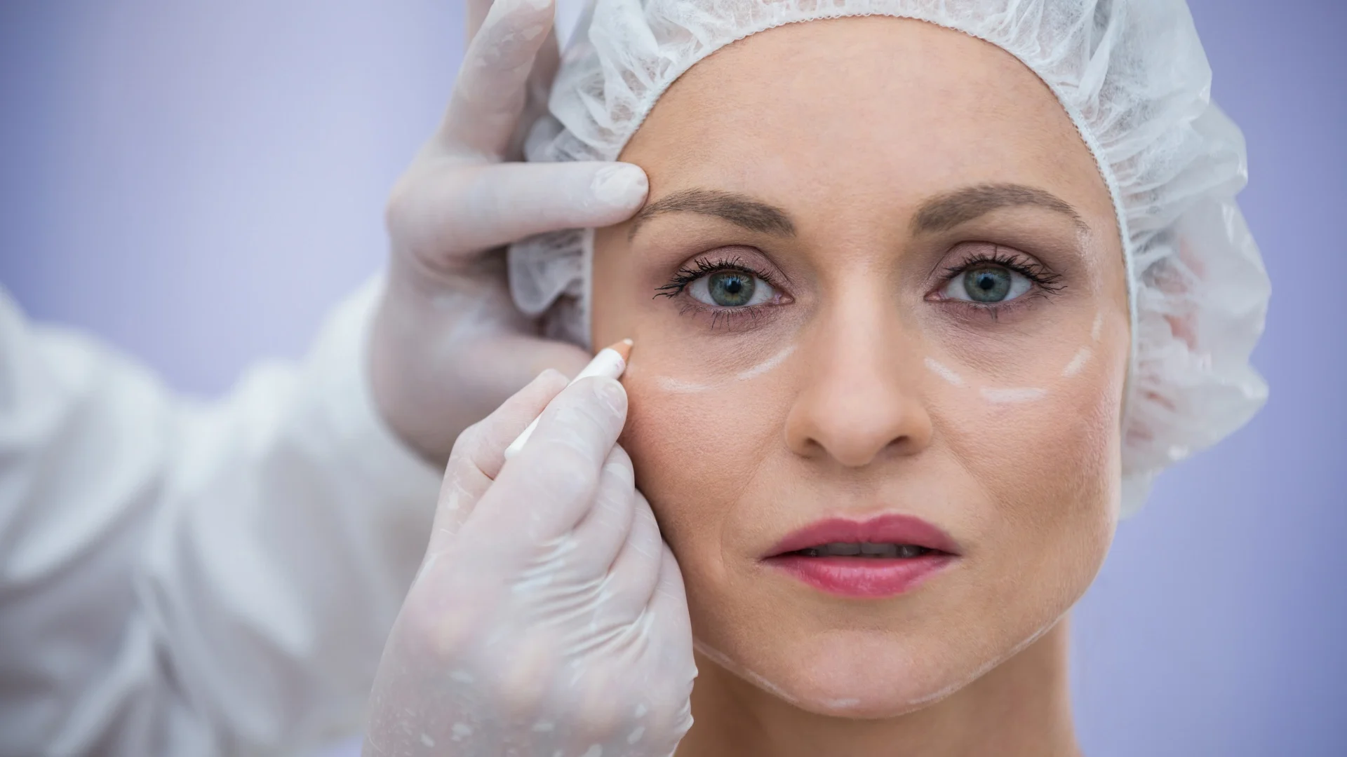 que es la blefaroplastia