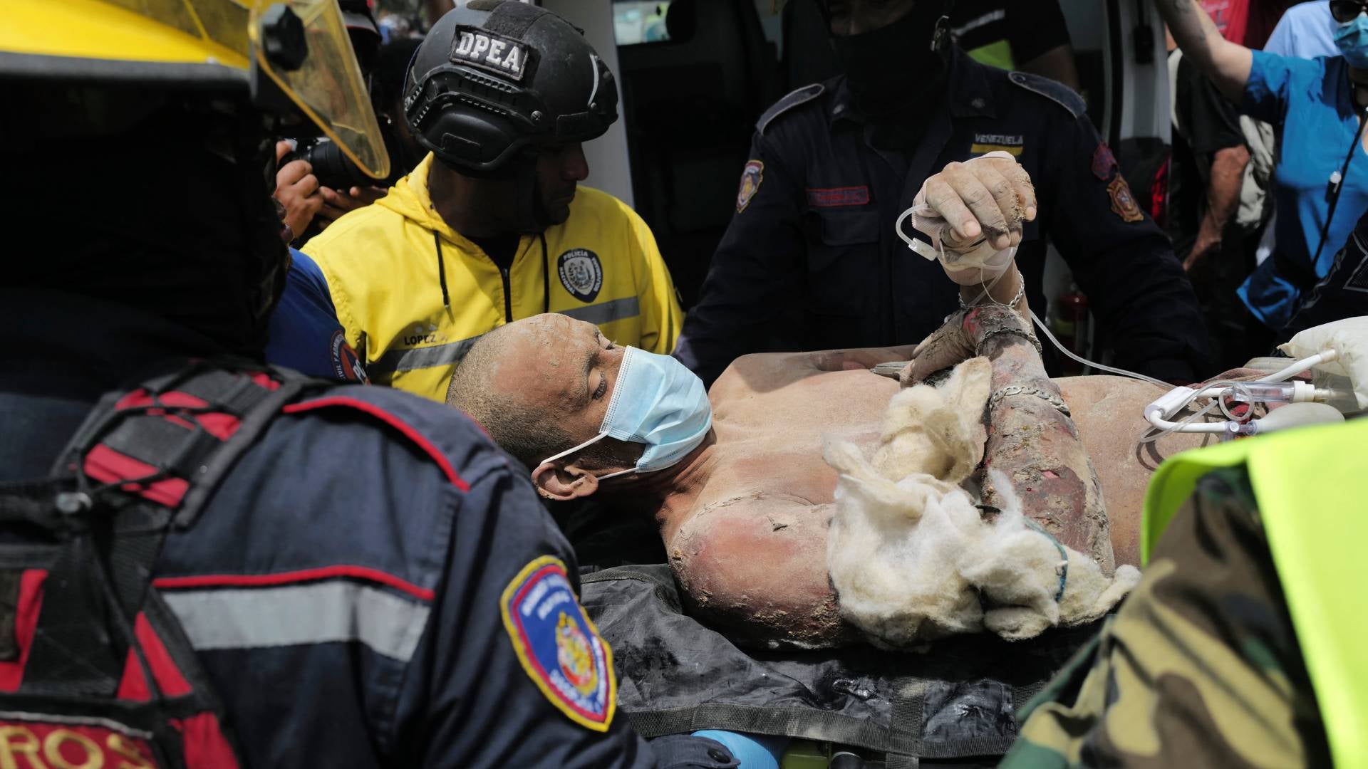 Propagación de enfermedades en Venezuela