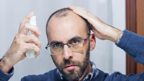 Invima prohíbe popular producto para la caída el cabello: se reportaron efectos adversos