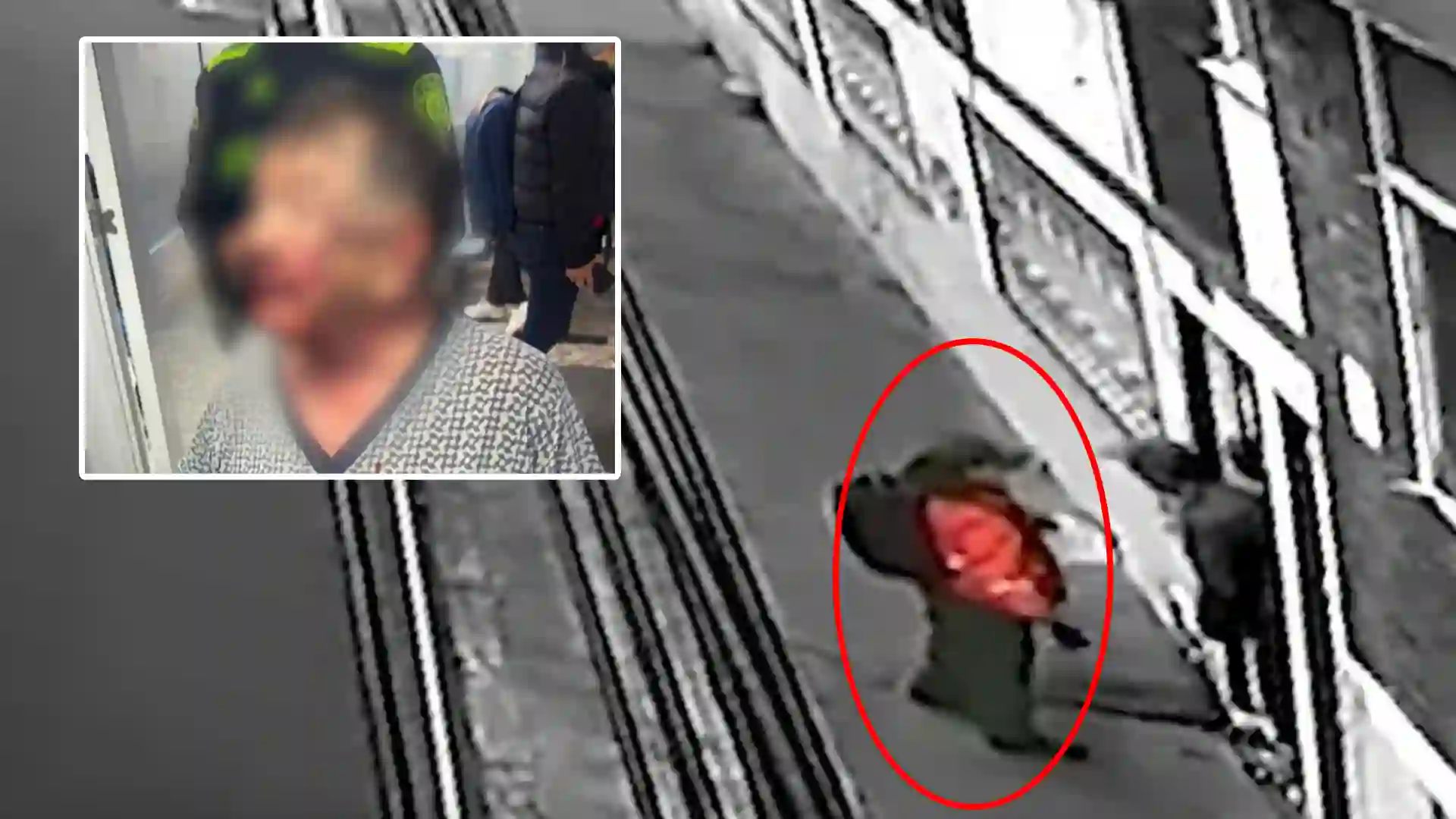 Abuelito brutalmente golpeado por ladrones disfrazados de funcionarios del Acueducto en Bogotá