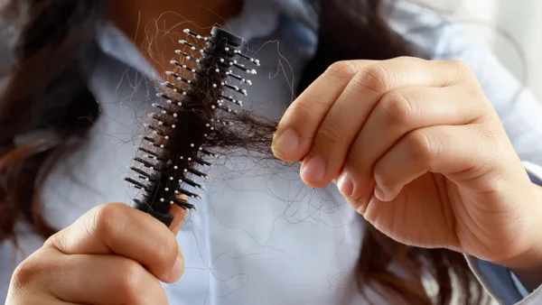 Cómo combatir la caída del cabello: Rutina y consejos eficaces Cómo combatir la caída del cabello: Rutina y consejos eficaces