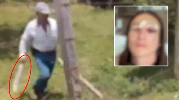 VIDEO | Le desfiguró el rostro a machetazos a su vecina de 26 años por un reclamo VIDEO | Le desfiguró el rostro a machetazos a su vecina de 26 años por un reclamo