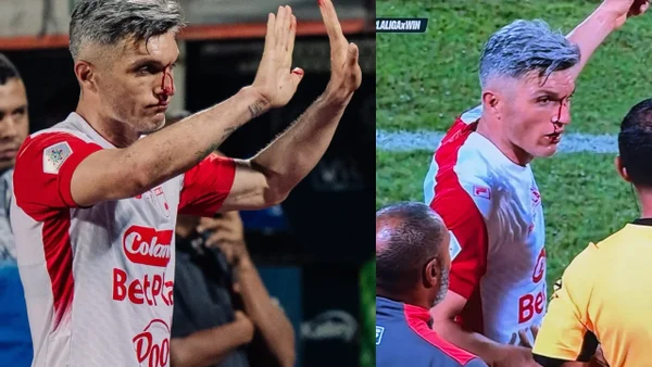 Lamentable: jugador de Independiente Santa Fe fue agredido en Itagüí y terminó con la cara cubierta de sangre