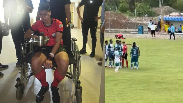 Video | Escándalo en Ecuador: jugador le fracturó el pómulo a un árbitro con una piedra